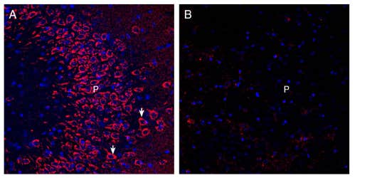 Anti-Neuronal Pentraxin Receptor (NPTXR)(extracellular) Antibody