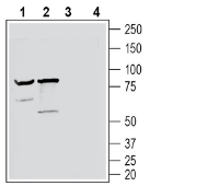 Neuronal Pentraxin Receptor (NPTXR) (extracellular) Blocking Peptide