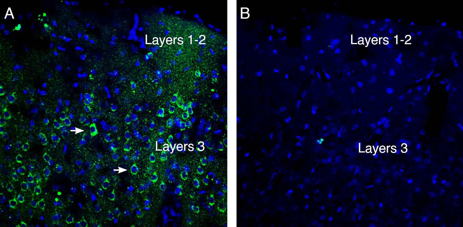 Anti-Neogenin (extracellular) Antibody