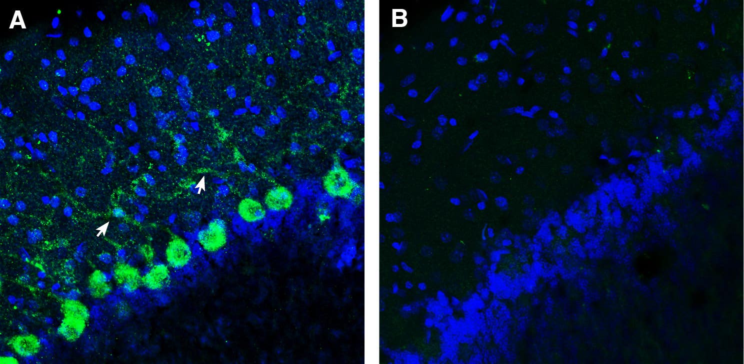 Anti-SLC36A1 (PAT1) Antibody
