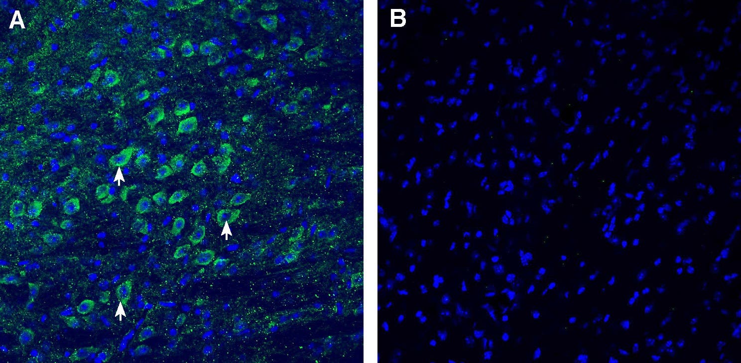 Anti-CADM1/SynCAM (extracellular) Antibody