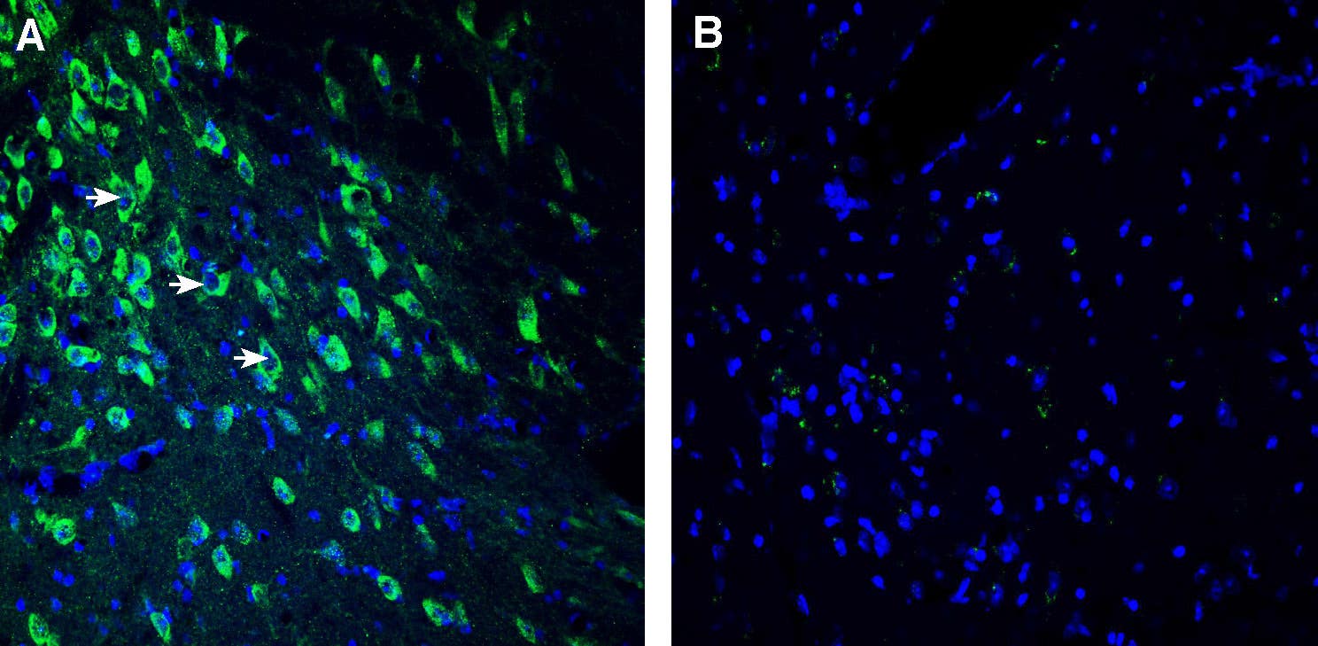 Anti-SEZ6 (extracellular) Antibody
