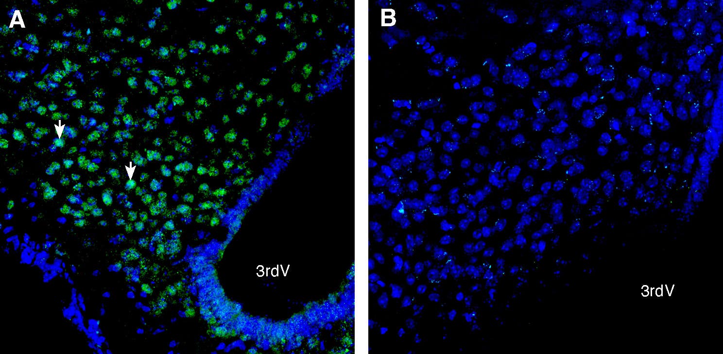 Anti-PTGFRN (extracellular) Antibody