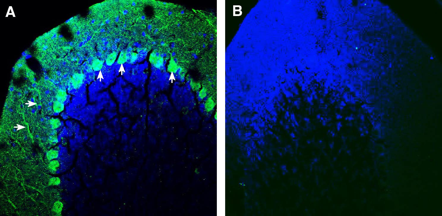 Anti-SLIT1 Antibody
