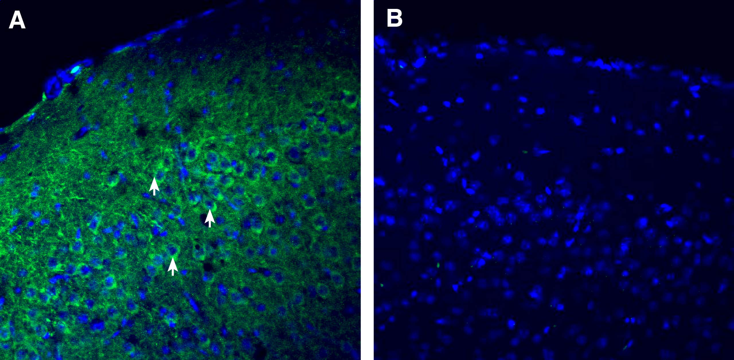 Anti-SPARC Antibody