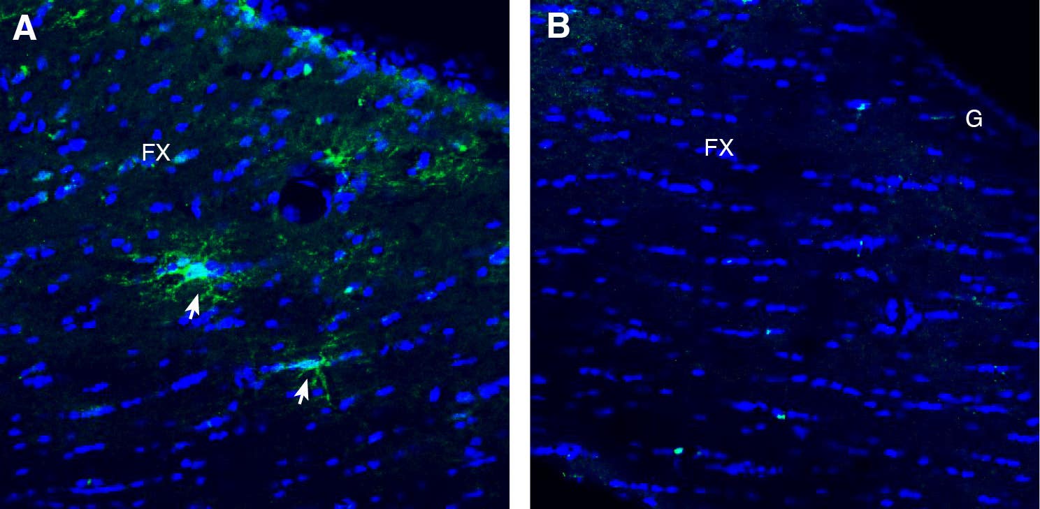 Anti-TMEM108 (extracellular) Antibody