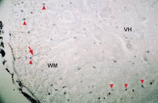 Anti-Neurotrophin 4 (NT-4) Antibody