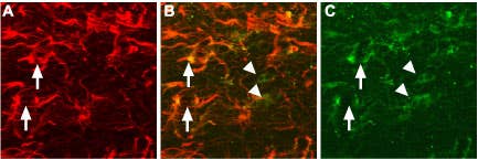 Anti-proNGF Antibody