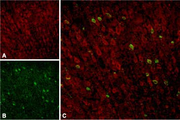 Anti-Sortilin (extracellular) Antibody