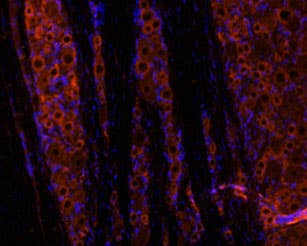 Anti-GDNF Antibody