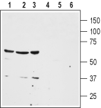 Neurotensin Receptor 1 (extracellular) Blocking Peptide