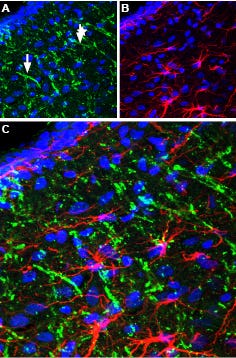 Anti-Neurotensin Receptor 2 Antibody