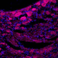Anti-TrkA (extracellular)-ATTO Fluor-633 Antibody