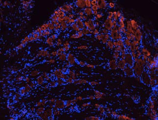 Anti-TrkB (extracellular) Antibody
