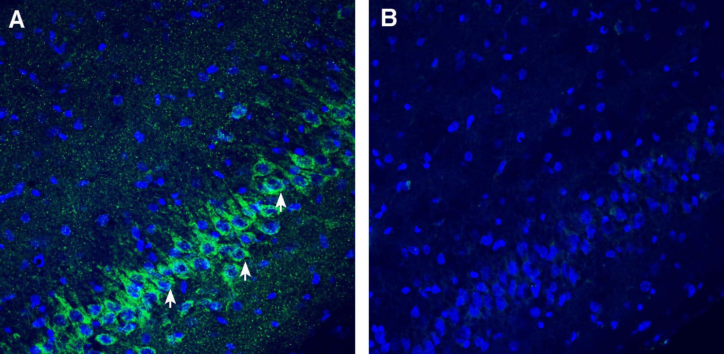 Anti-SLC25A22 (GC1) Antibody