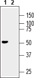 GFR α 3 (extracellular) Blocking Peptide