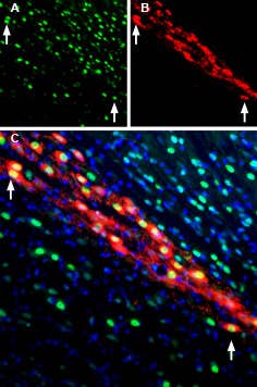 Anti-CDNF Antibody