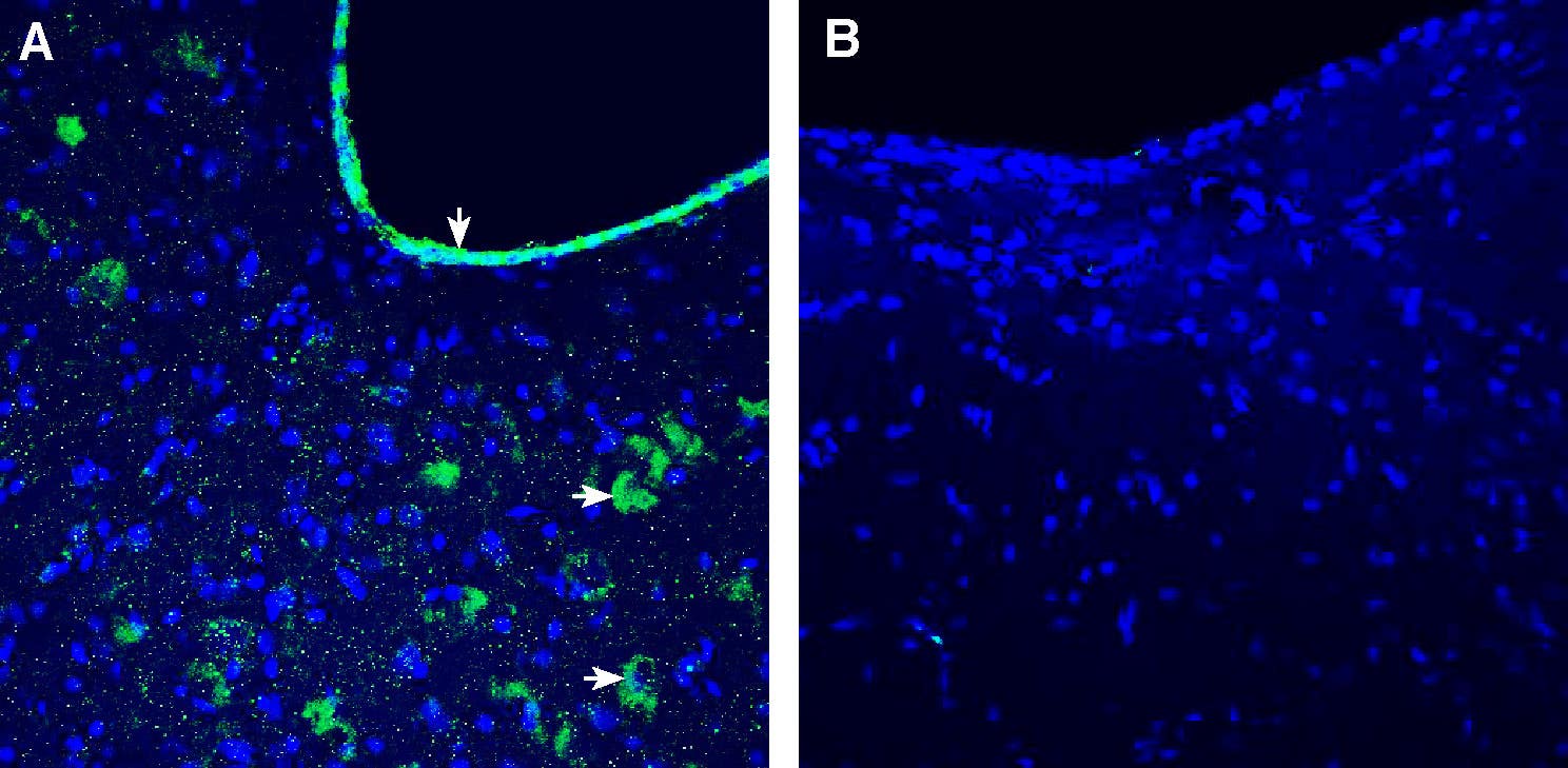 Anti-GFRAL (extracellular) Antibody