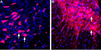 Anti-LINGO-1 (extracellular) Antibody