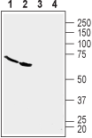 TROY/TNFRSF19 (extracellular) Blocking Peptide