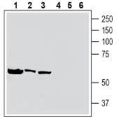 Human Tumor Necrosis Factor Receptor 2 (extracellular) Blocking Peptide