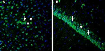 Anti-IGF1R (extracellular) Antibody