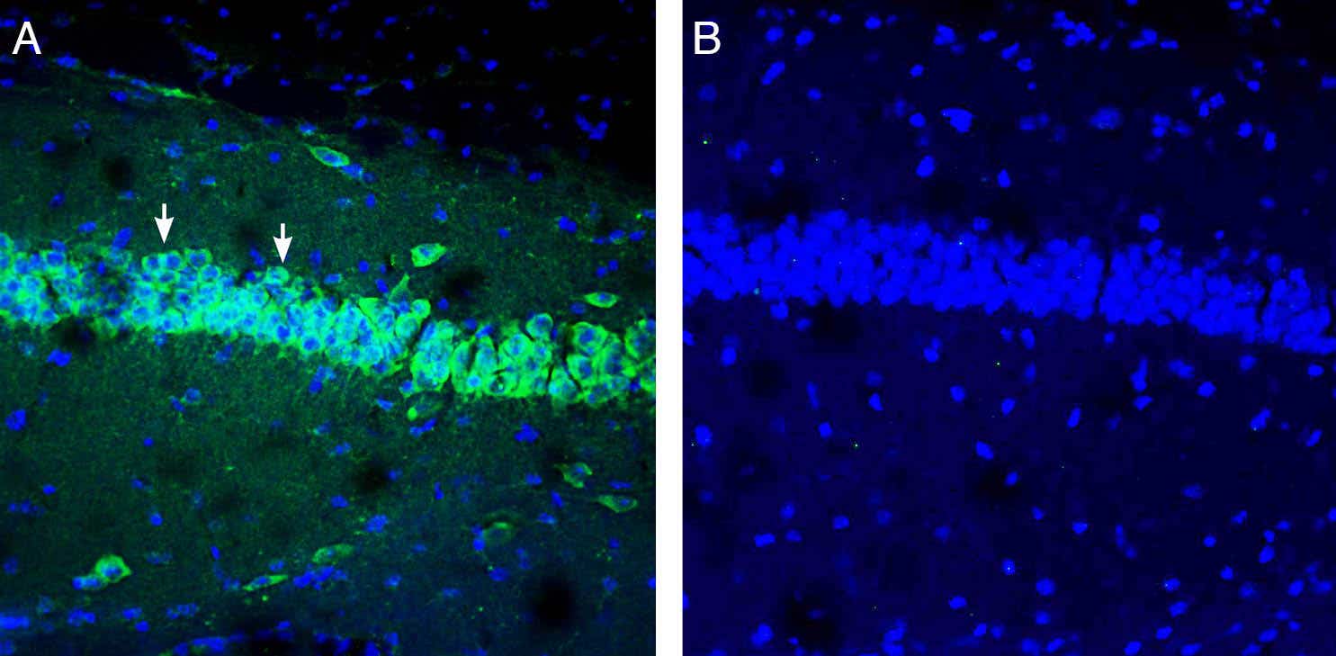Anti-IGF1 Antibody
