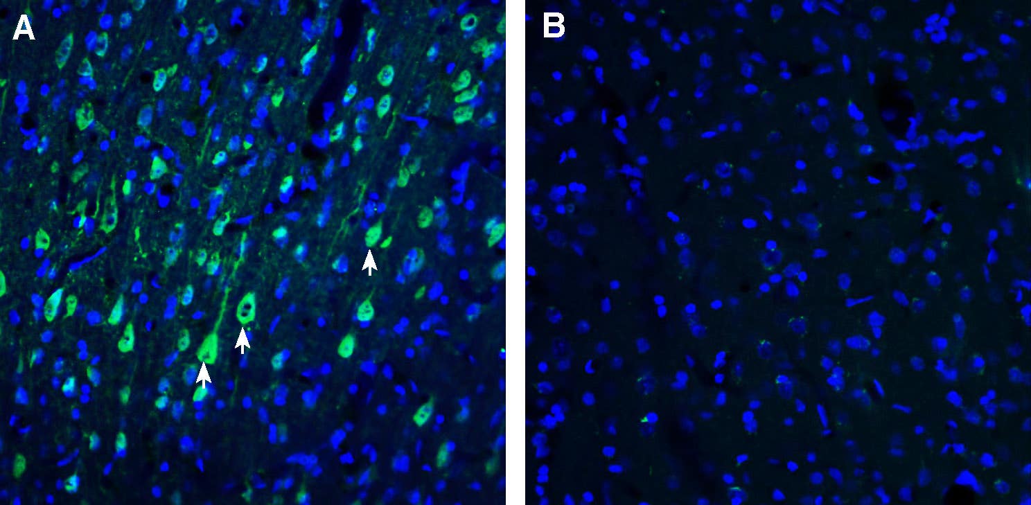 Anti-CART Antibody