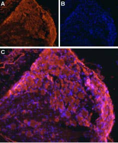 Anti-ENT1 (SLC29A1) Antibody