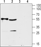 Anti-ENT2 (SLC29A2) Antibody - Carrier Free