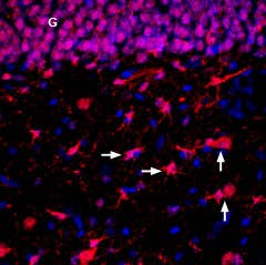 Anti-ENT2 (SLC29A2) Antibody