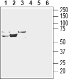 Anti-ENT3 (SLC29A3) Antibody