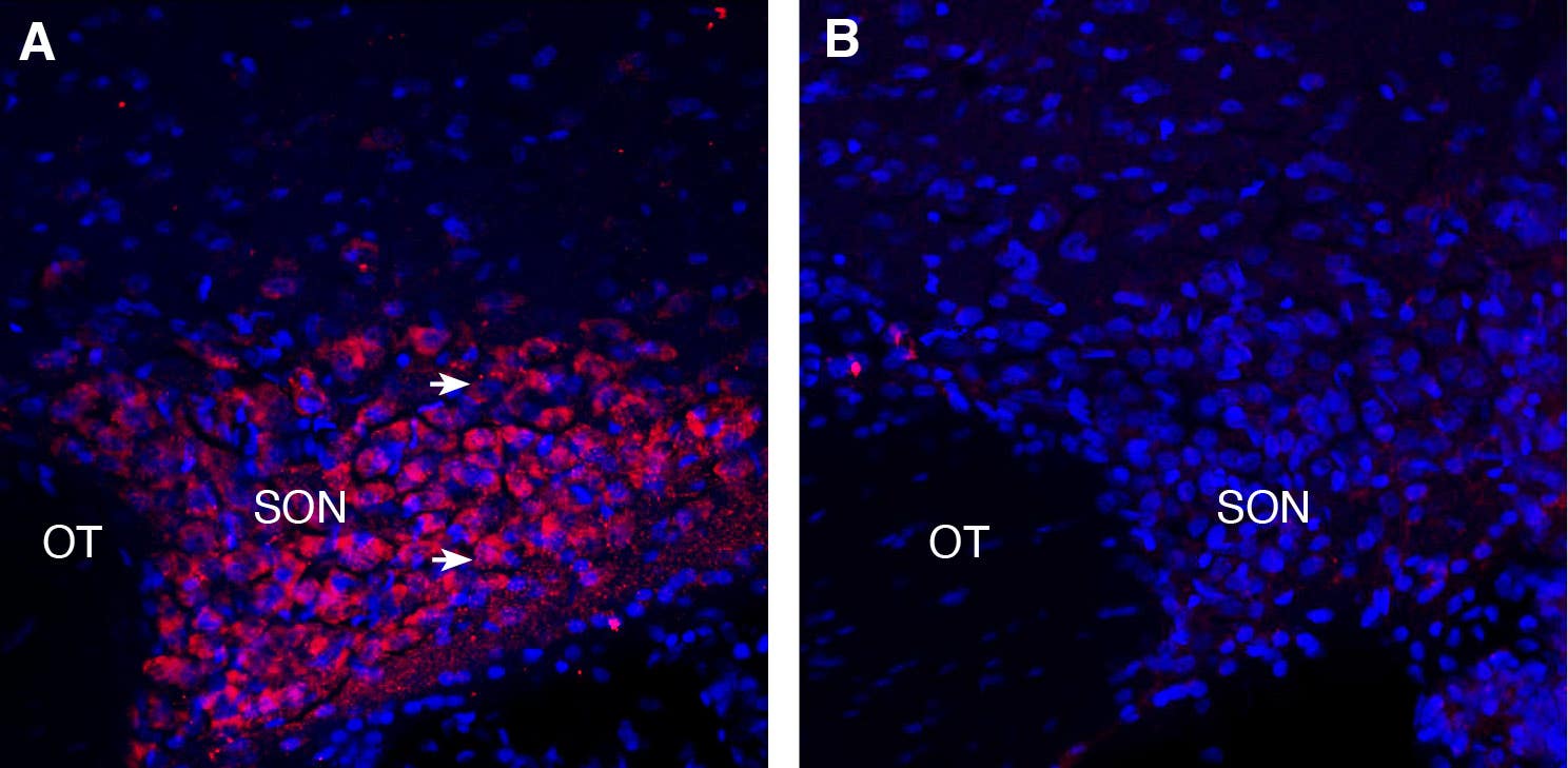 Anti-PMAT (SLC29A4) Antibody