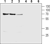 Anti-SLC28A1 (CNT1) Antibody