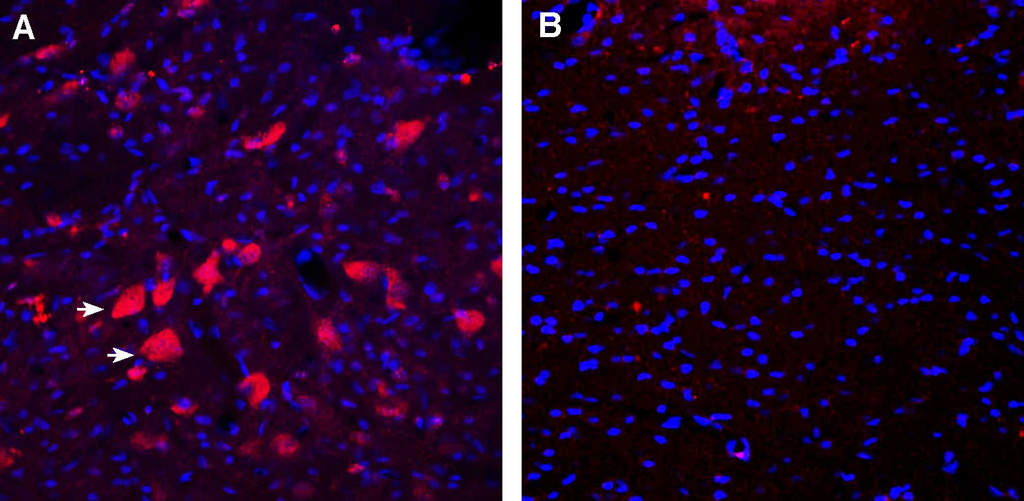 Anti-CD157/BST1 (extracellular) Antibody