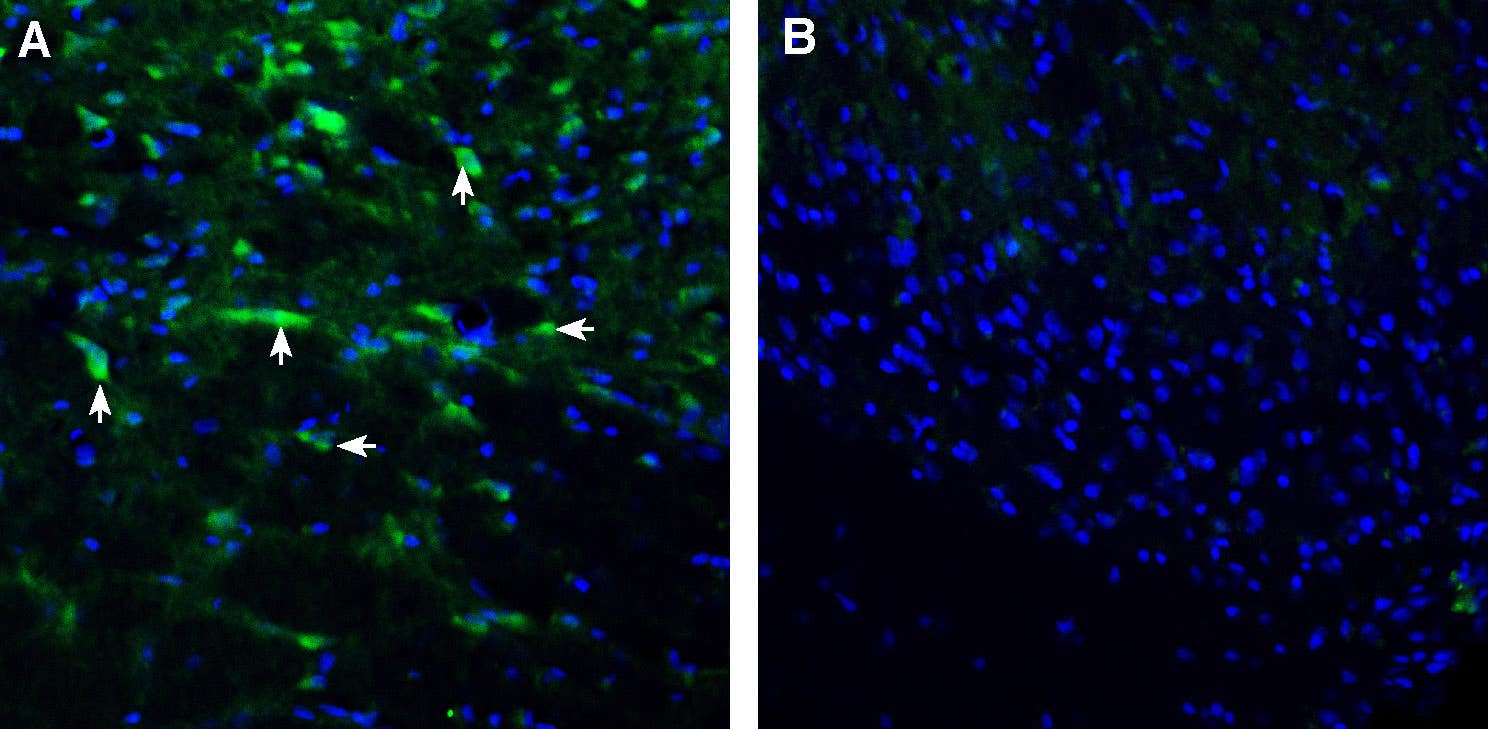 Anti-ENPP1 (extracellular) Antibody