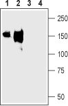 Anti-NKCC2 (SLC12A1) Antibody