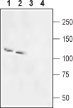 Rat SLC4A5/NBC4 Blocking Peptide