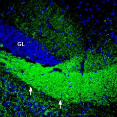 Anti-ASCT2 (SLC1A5) Antibody