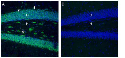 Anti-SLC7A2 (extracellular) Antibody