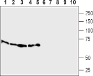 SLC7A2 (extracellular) Blocking Peptide