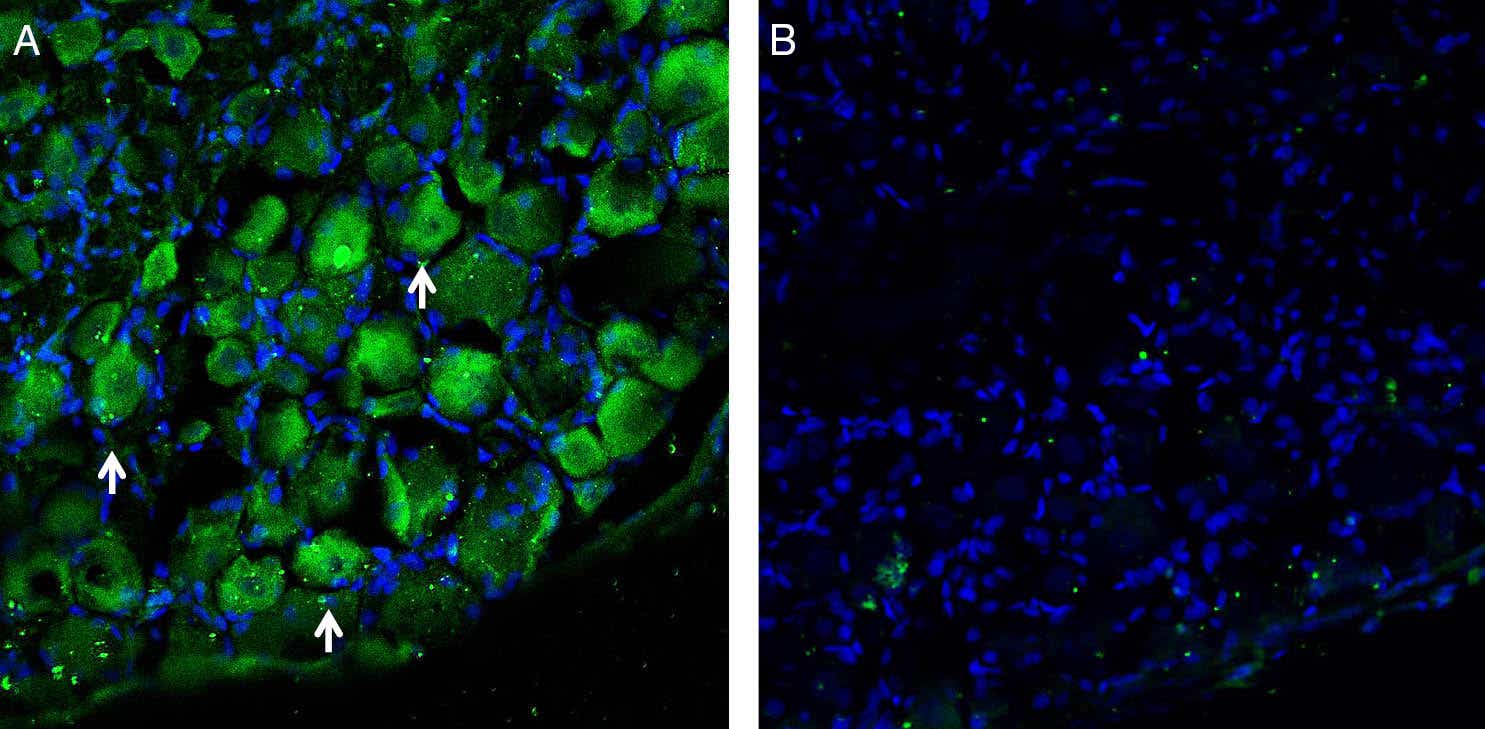 Anti-LAT1 (SLC7A5) Antibody