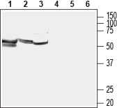 LAT1/SLC7A5 Blocking Peptide