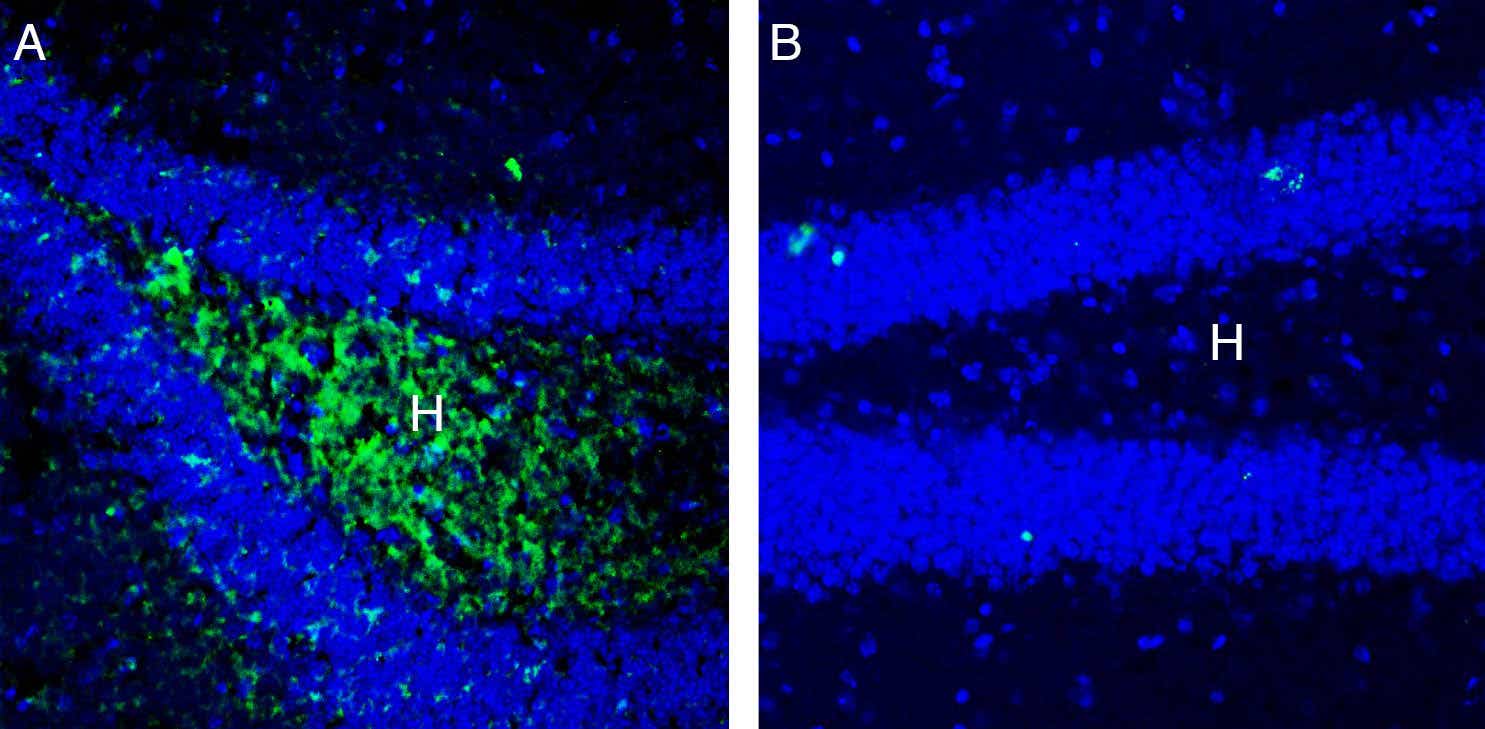 Anti-LAT2 (SLC7A8) (extracellular) Antibody