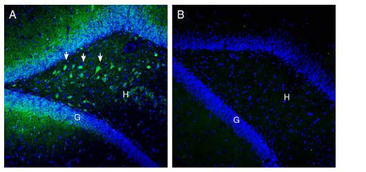 Anti-SLC25A12 Antibody