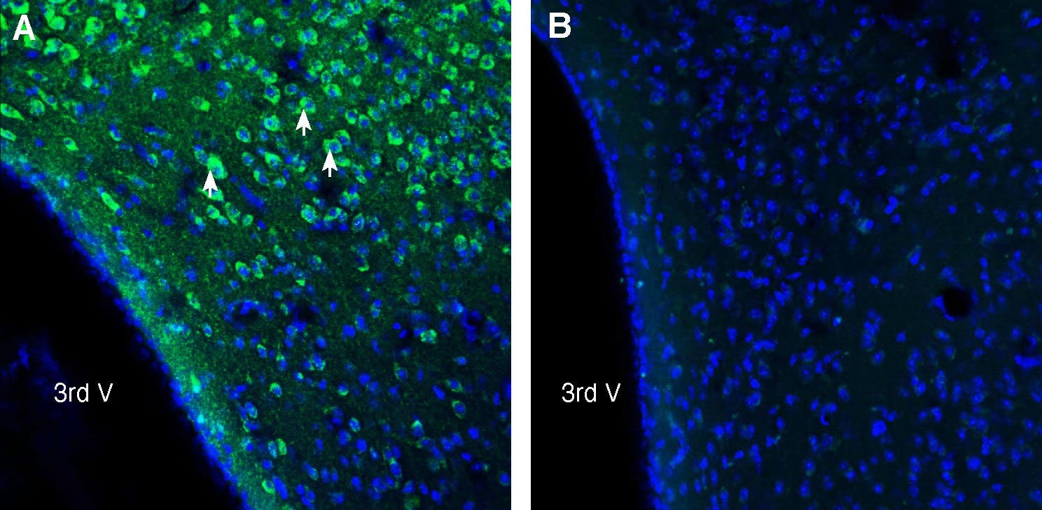 Anti-UCP2 Antibody