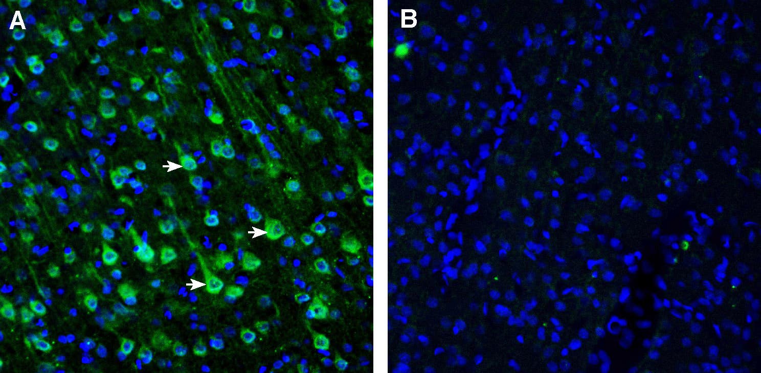 Anti-SLC47A1 Antibody