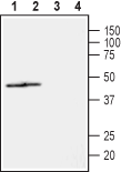 Anti-NIPA2 (extracellular) Antibody