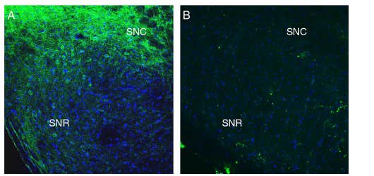 Anti-SLC41A2 (extracellular) Antibody