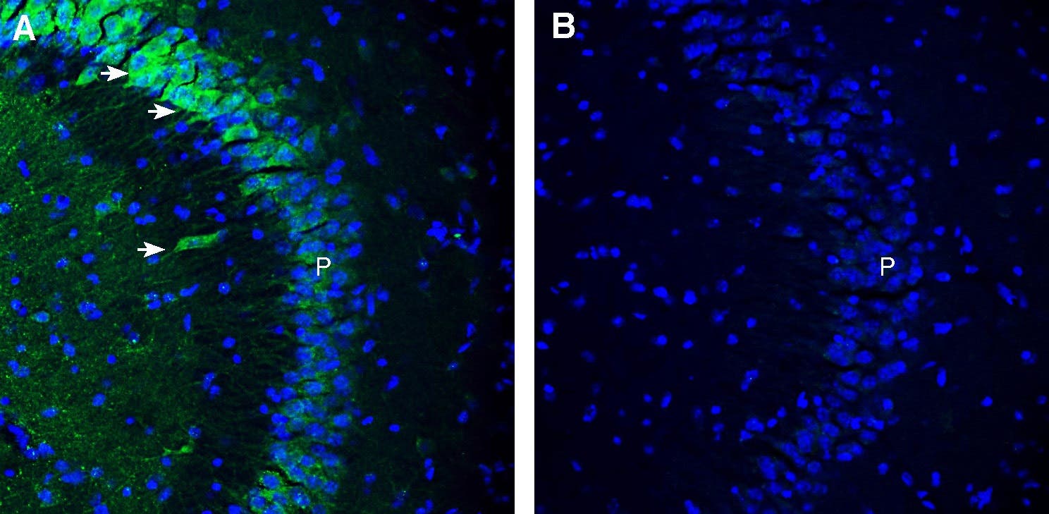 Anti-MRS2 Antibody